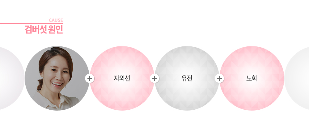 원인
유전
자외선
노화
